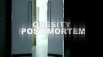 Obesity: The Post Mortem