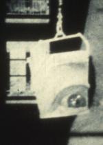 Optic Nerve